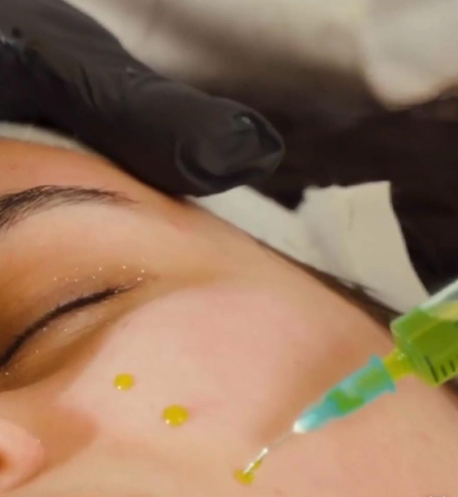 Studio Avance - BioRePeel